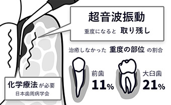 従来の治療方法