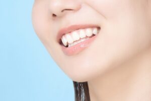 CAD/CAM冠とは？│保険で白い奥歯ができる時代に